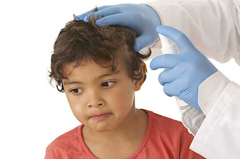 Why Lice Isn't Always a Bad Thing